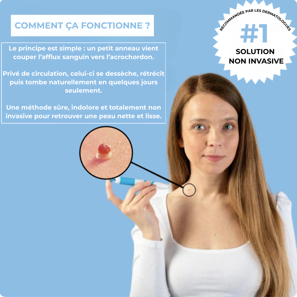 Kit Dermis Skin Pro - Adieu les acrochordons