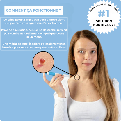 Kit Dermis Skin Pro - Adieu les acrochordons